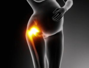 Hip Pain During Pregnancy