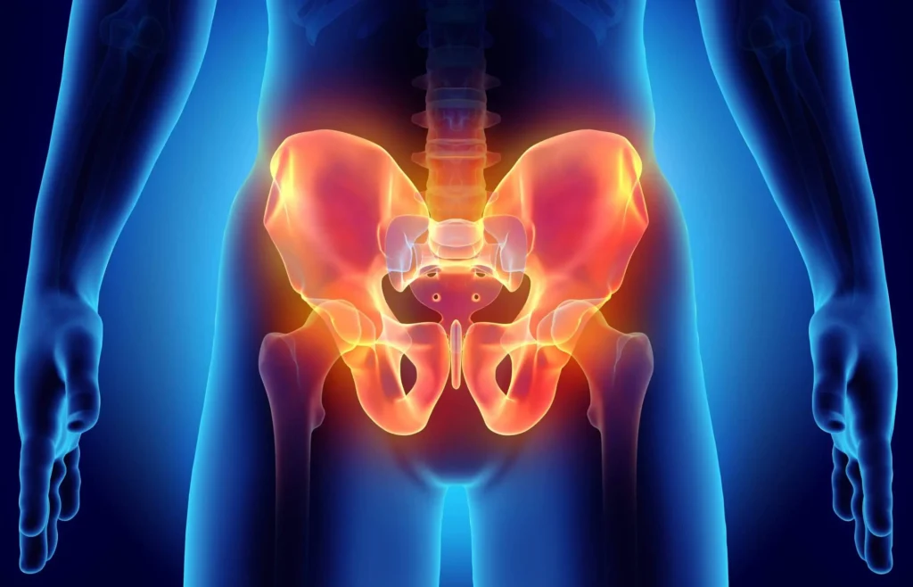 Understanding Chronic Pelvic Pain Syndrome (CPPS)