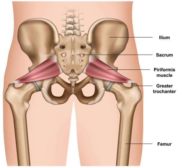 Piriformis Syndrome