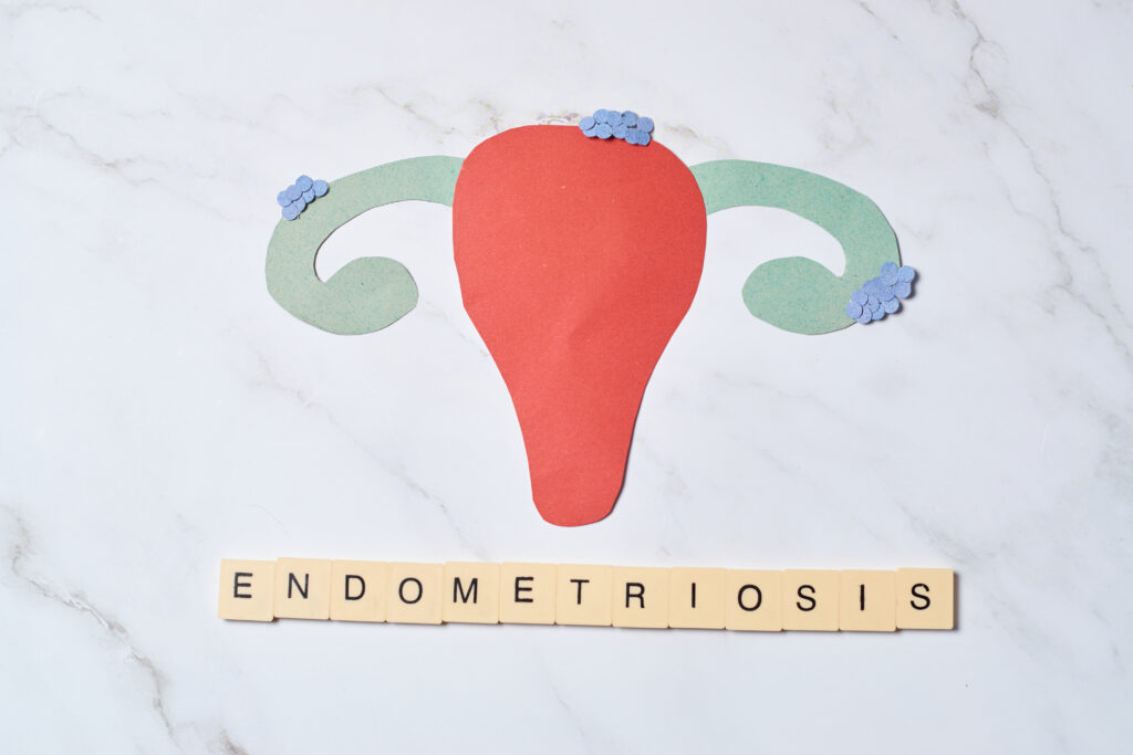 Endometriosis